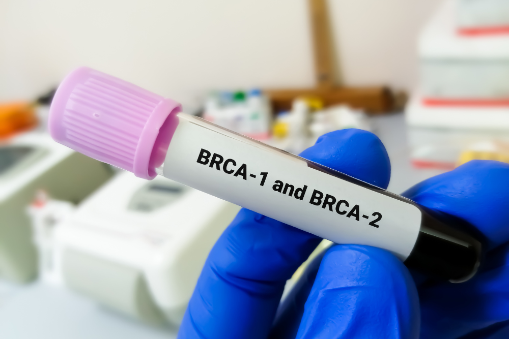 A blood sample for BRCA Gene Testing